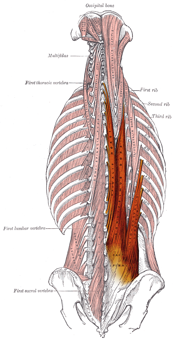 Gray's plate of the deep muscles of the back seen from behind, with the erector spinae group — iliocostalis, longissimus and spinalis — highlighted as a continuous column running from the sacrum and iliac crest to the occiput over the transverse processes and ribs, with multifidus and semispinalis alongside.