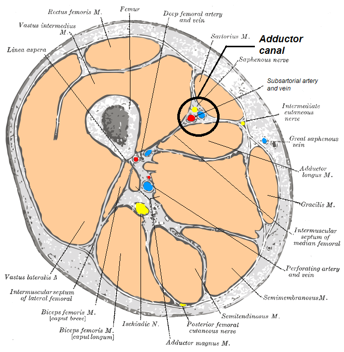 A transverse section through the mid-thigh with the adductor canal circled, showing the saphenous nerve alongside the subsartorial artery and vein deep to sartorius, the femur and quadriceps group anteriorly, and the sciatic nerve in the posterior compartment.